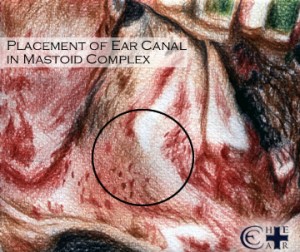 Placement of Ear Canal in Mastoid Complex