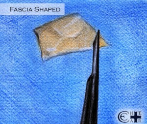 Fascia Shaped